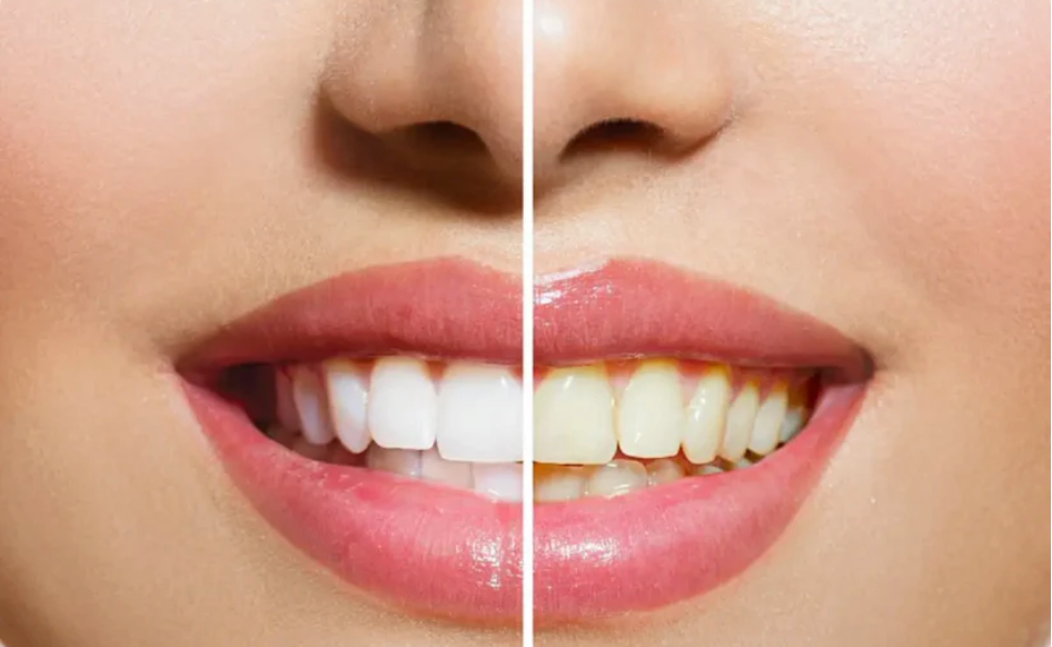 1 dentifrice + 1 brosse à dents (+ 2 siwak offerts)